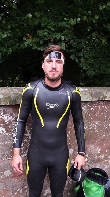 Calum Hudson with bandaged head